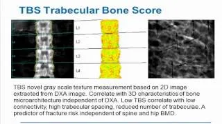 Osteoporosis and Advances in Metabolic Bone Disease - Ep. 5