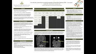 ACP Georgia 2021 Tolosa Hunt Syndrome