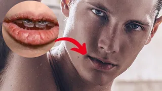 How To Have PERFECT LIPS As A Guy (Looksmaxing)