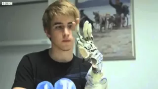 Amputee демонстрирует новую бионическую руку