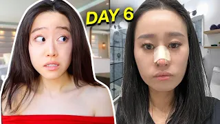 MY SISTER GOT A NOSE JOB!!