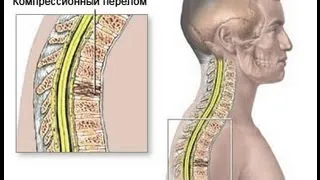 Жестокие удары, куда их наносить. Система Спецназ.