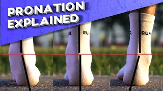 What is overpronation? | Pronation types explained