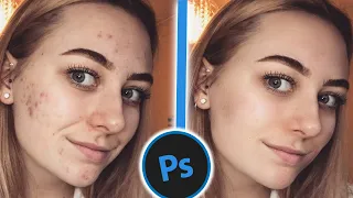 РЕТУШЬ КОЖИ ЗА 1 МИНУТУ В Adobe Photoshop