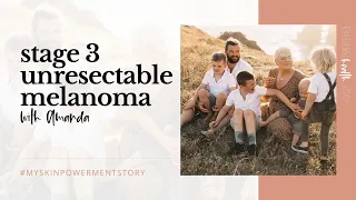 STAGE 3 UNRESECTABLE MELANOMA STORY WITH AMANDA