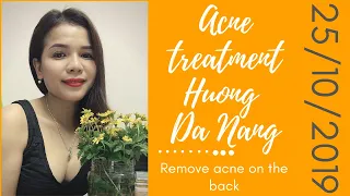 [Acne treatment Hương Đà Nẵng]Remove acne on the back 25/10/2019