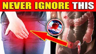 Critical COLON CANCER Symptoms You Should NEVER IGNORE | What Happens To Your Body