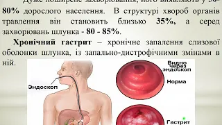 Фізична реабілітація при гастриті