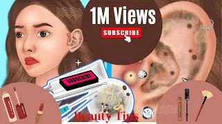 Relax Every Day｜removal of acne blackheads and sebaceous cysts for girls listening to music