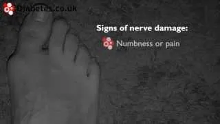 How to Check Your Feet For Signs of Nerve Damage