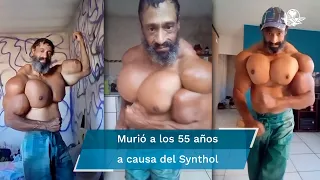 Muere el “Hulk brasileño”, se inyectaba aceite para aumentar su musculatura