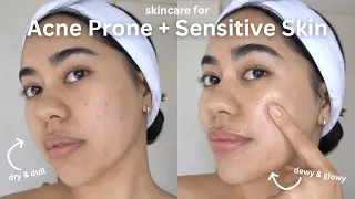 Acne Prone + Sensitive Skincare 🌿 (glowy skin and acne fighting)