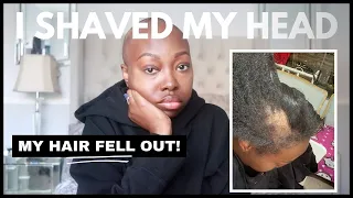 I Shaved My Head!!! All My Hair Fell Out in 24 Hours!