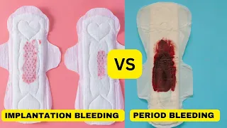 Implantation Bleeding vs. Period: Spotting the Differences