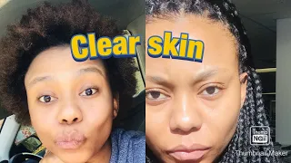 How to Remove dark spots/DIY/Facial mask/SA /Youtuber