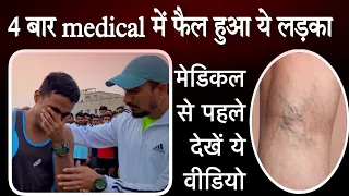 SSC GD MEDICAL TEST DETAILS |  पाँवो की नस फूल जाने का आसान treatment । VARICOSE VEINS SYMPTOMS |