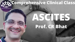 ASCITES Clinical case presentation