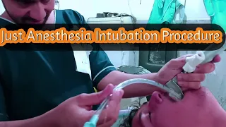 General Anesthesia Intubation Procedure |Just General Anesthesia Intubation video| Anesthetic Waseem