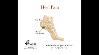 TREATING PLANTAR FASCIITIS AND HEEL PAIN WITH ACUPUNCTURE