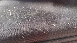 ASMR dandruff scratching test 1