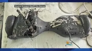 Hoverboard Explosion Causes Major Damage To Dania Beach Home