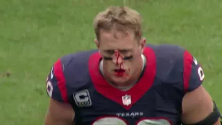 JJ Watt gets a bloody nose after tackling Russell Wilson (9/29/2013)