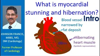 What is myocardial stunning and hibernation? Intro