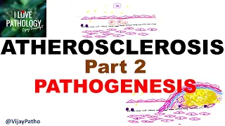 ATHEROSCLEROSIS : Part 2- Pathogenesis