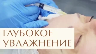 💧  Что такое биоревитализация лица, как проходит процедура. Процедура биоревитализации лица. 12+