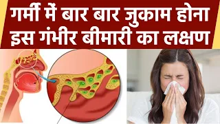 गर्मी में जुकाम होना Sinusitis Symptoms, क्या है Treament | Boldsky