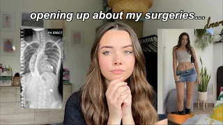 which surgeries have I had on my body? my scoliosis story 🩻🤍