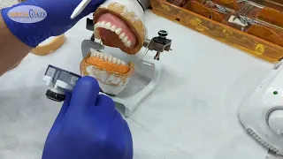 neutral zone technique in complete denture