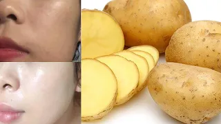 Japanese secret to whitening 10 degrées that eliminates pigmentation and dark spots | Beauty Perfect