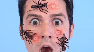GIANT ANTS ON FACE SURPRISE!