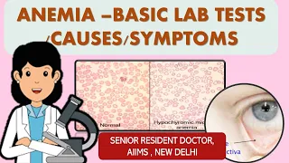 ANEMIA- BASIC LAB TESTS ( ANIMATED VIDEO !!! )