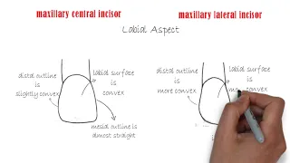 Differences between Permanent Maxillary Central Incisor and Permanent Maxillary Lateral Incisor