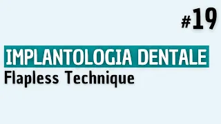 Implantologia Dentale - Flapless Technique