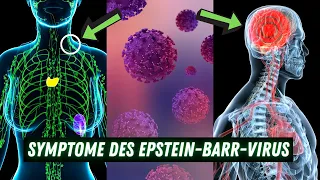 14 Symptome des Epstein-Barr-Virus, die du niemals ignorieren solltest