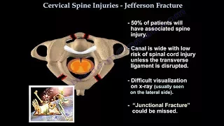 Jefferson Fracture - Everything You Need To Know - Dr. Nabil Ebraheim