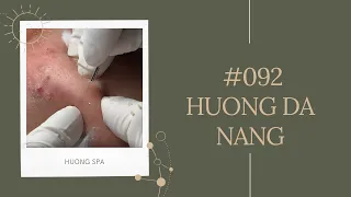 #092 | Huong Da Nang