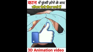 कान में फुंसी होने के बाद डॉक्टर कैसे ठीक करते हैं। 3D Animation 😲#shorts#short#knowledge#shortvideo