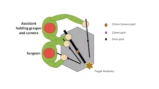 Learning Laparoscopic Sigmoid Colectomy (High Anterior Resection)