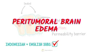 Peritumoral brain edema | a type of vasogenic cerebral edema | Neuroaholics