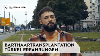 #Barthaartransplantation Türkei – Erfahrungen von Sebastian