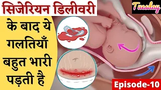 सिजेरियन डिलीवरी के बाद ये गलतियाँ बहुत भारी पड़ती है ||  C-section/ Post Cesarian Recovery Tips