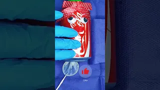 Shocking cola Surgery ASMR 😱 Removing Foreign Objects from a Cola Exotic Hospital  asmr doctor #asmr