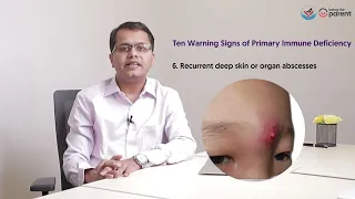 Ten Warning Signs of Primary Immune Deficiency