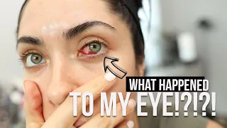 About my pterygium surgery...| surfer's eye | Melissa Alatorre