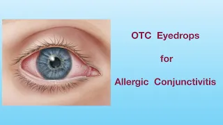 OTC eyedrops for Allergic conjunctivitis