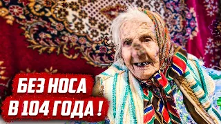 Слабонервным не смотреть! - Долгожительница без носа | Бугуруслан Оренбургская обл.